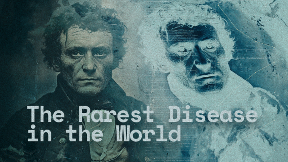 14952 Online Results Brochure The Rarest Disease In The World Cover Image 640X360 V1